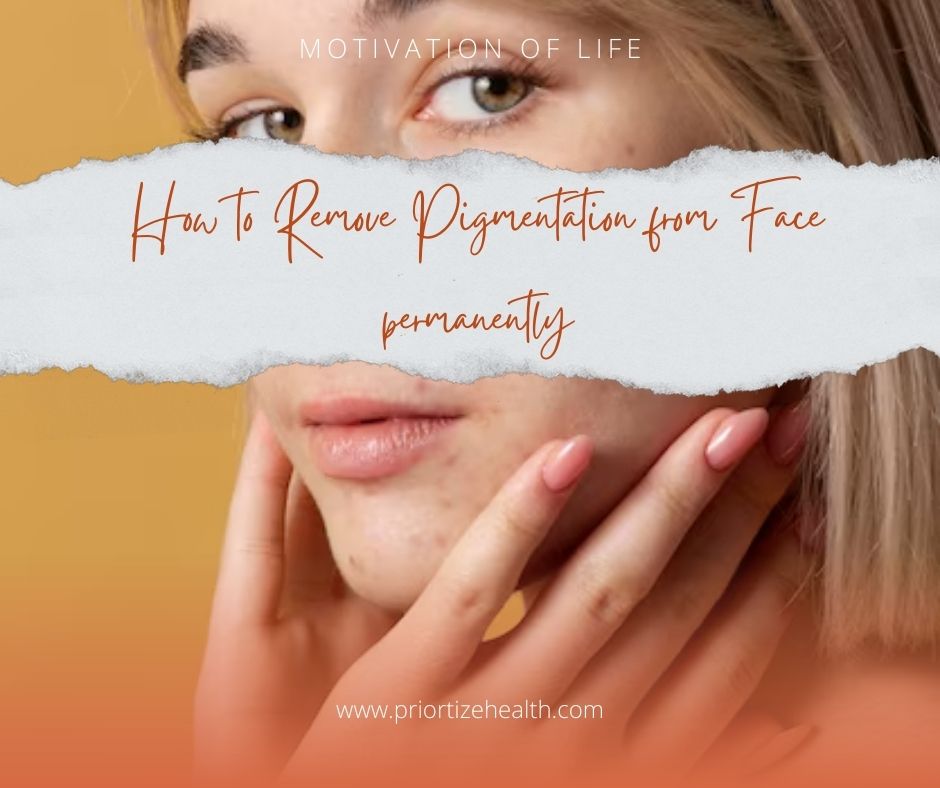 How to Remove Pigmentation from Face permanently