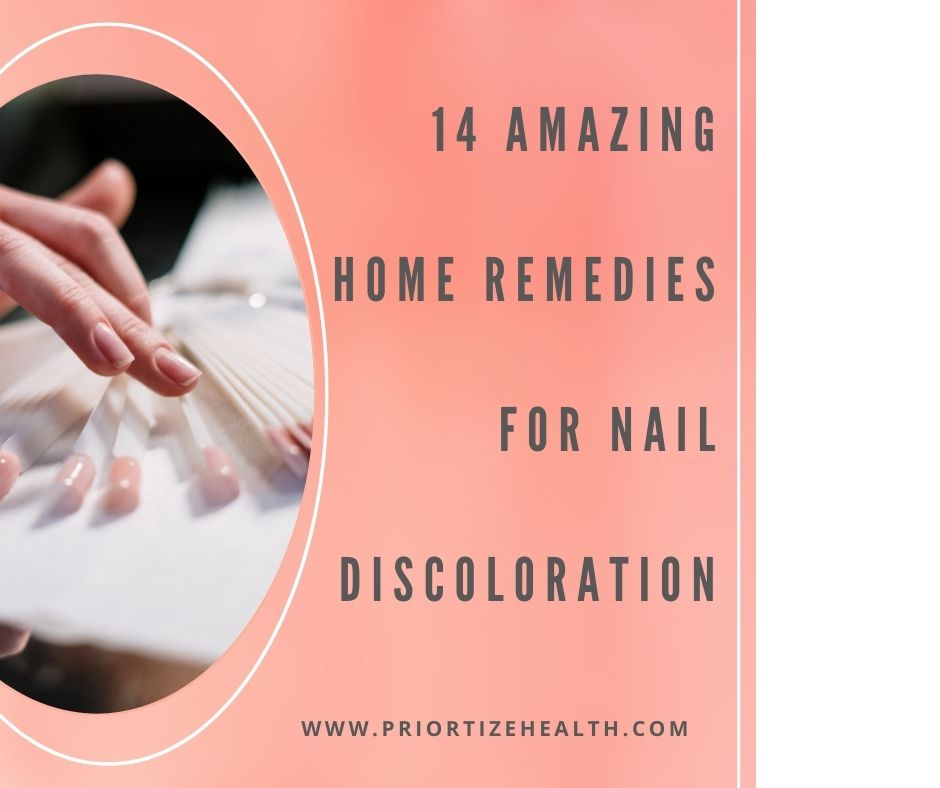 home remedies for nail discoloration