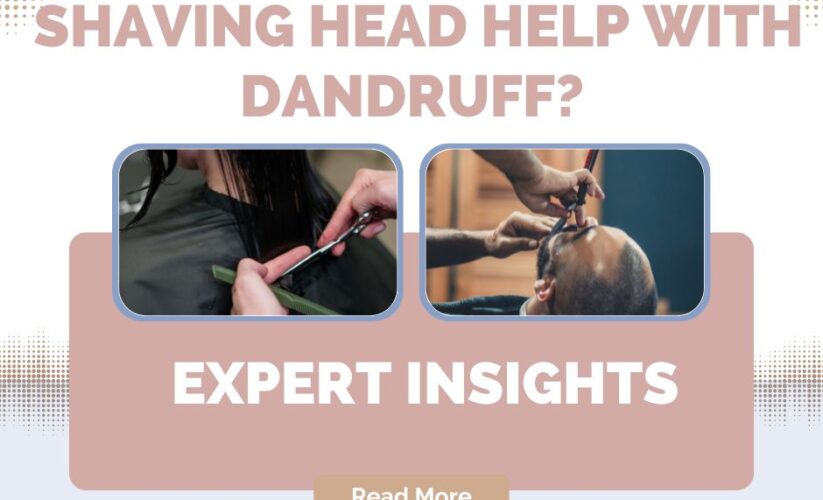 Does Cutting Hair or Shaving Head Help with Dandruff